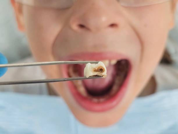Best Walk-In Emergency Dentist in Coing, AL